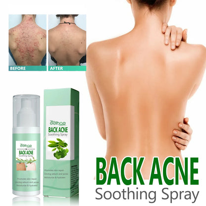 Back Acne Repair Spray