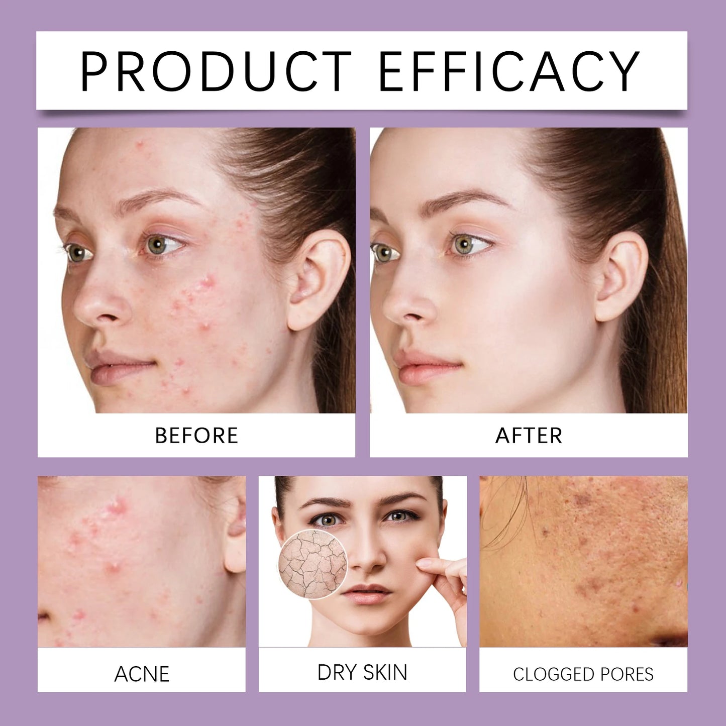 Berry Scented Blemish Lotion Care