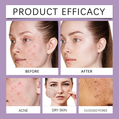 Berry Scented Blemish Lotion Care