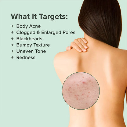 Back Acne Repair Spray