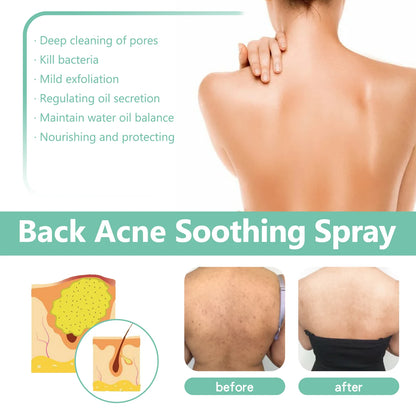 Back Acne Repair Spray